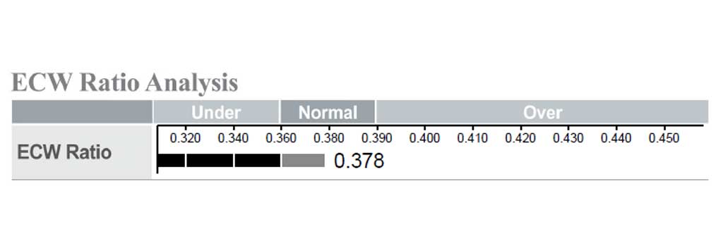 تفسیر ECW Ratio
